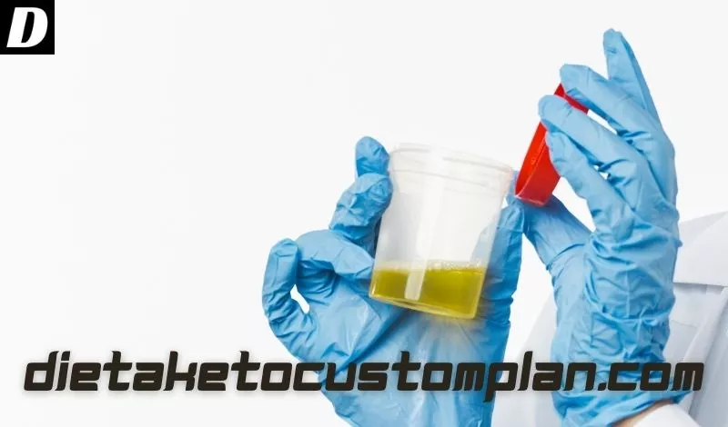 Protein In Urine Dietaketocustomplan 6096