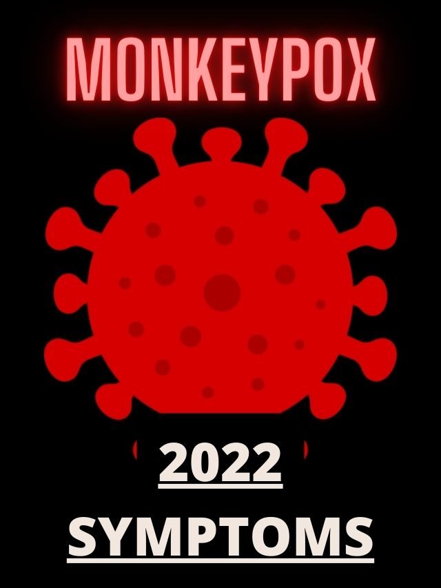 Monkeypox 2022